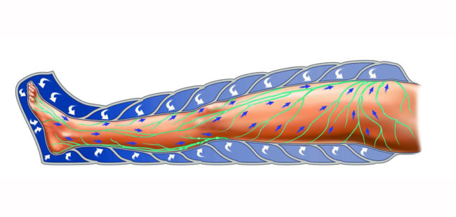 лимфодренажный массаж ног